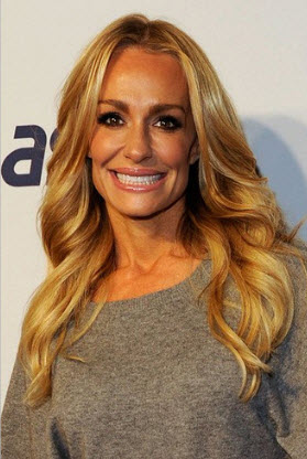 Taylor Armstrong  Plastic Surgery on Taylor Armstrong